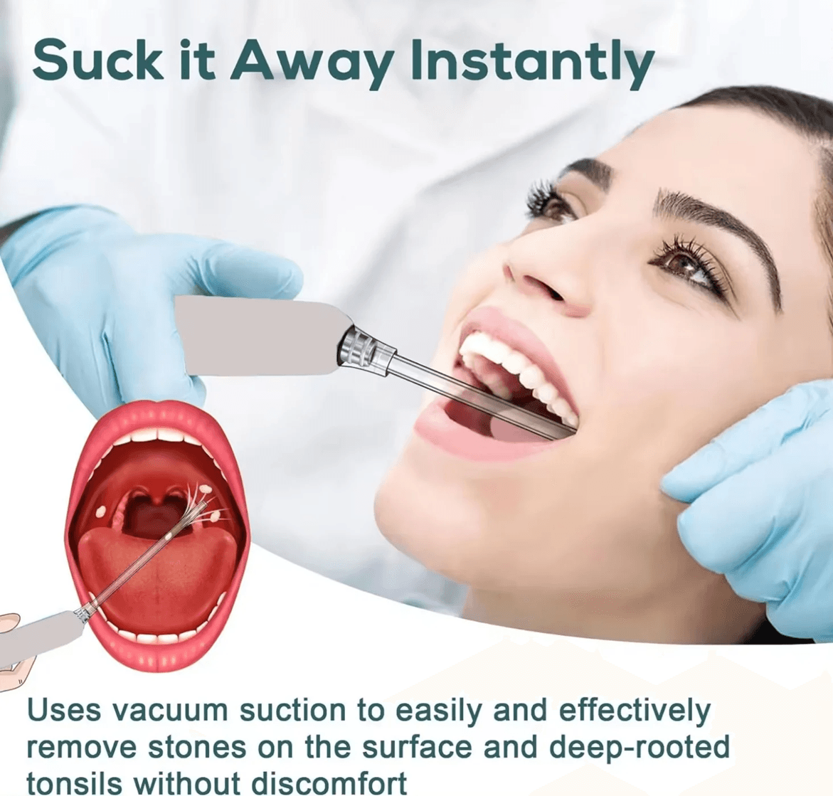 Electronic Tonsil Stone Remover Kit With Suction Modes And Oral Care Tools 2