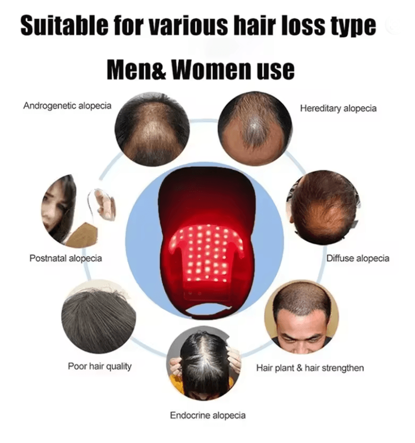 ReviveCap Pro  LED Red Light Therapy Cap For Hair Regrowth 2