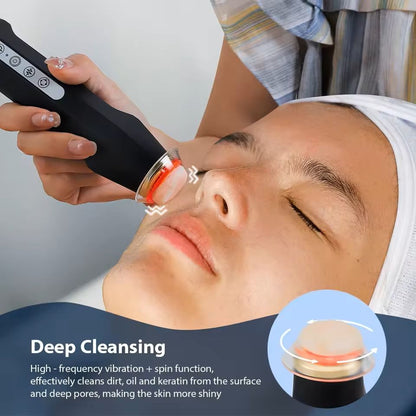 Portable Oxygen Bubble Facial Machine With CO2 Gel Skin Care Technology 1