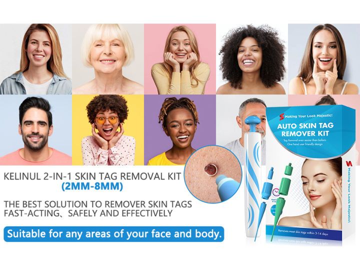 2in1 Skin Tag And Mole Remover Kit  Safe Painless AtHome Wart Removal Device 1