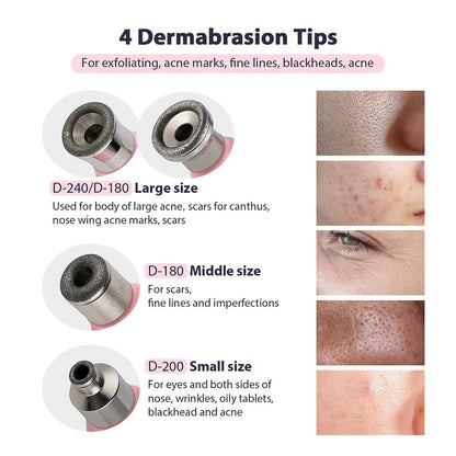 Portable Diamond Peeling Machine, Microdermabrasion Facial Cleaning Device & Vacuum Blackhead Remover
