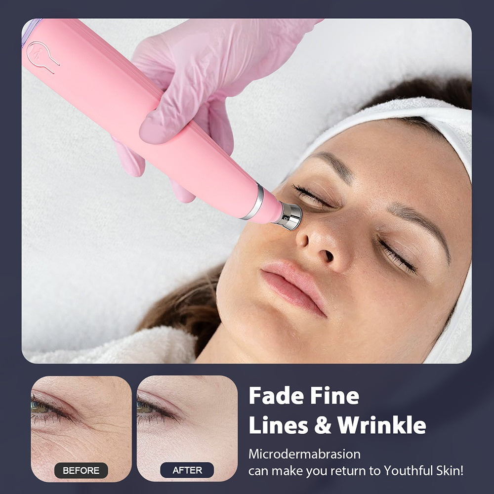 Portable Diamond Peeling Machine, Microdermabrasion Facial Cleaning Device & Vacuum Blackhead Remover