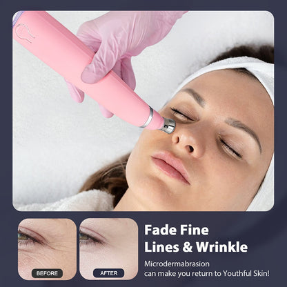 Portable Diamond Peeling Machine, Microdermabrasion Facial Cleaning Device & Vacuum Blackhead Remover