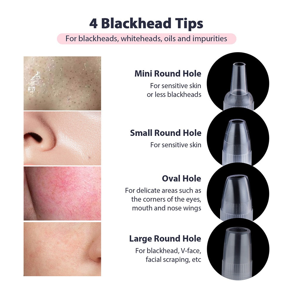 Portable Diamond Peeling Machine, Microdermabrasion Facial Cleaning Device & Vacuum Blackhead Remover