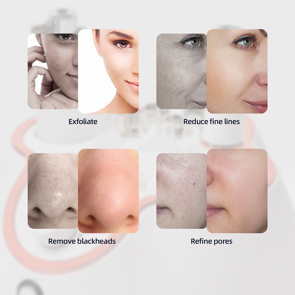 3in1 Professional Diamond Facial Peeling Machine Home Use Professional Microdermabrasion Exfoliatio 4