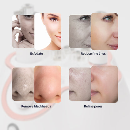 3in1 Professional Diamond Facial Peeling Machine Home Use Professional Microdermabrasion Exfoliatio 4