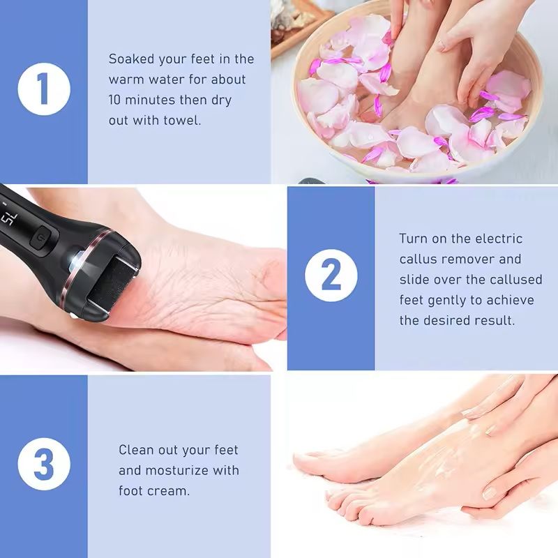 Electric Foot File Callus Remover Rechargeable Pedicure Tool 5