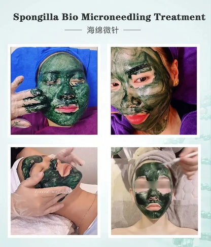Sponge Microcrystal Spicules Freeze-Dried Powder Collagen Booster, Natural Skin Cell Renewal Treatment Deep Dermis
