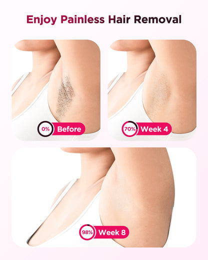 Flash IPL Hair Removal Device for Men & Women, 999,900 Flashes, Full Body Use