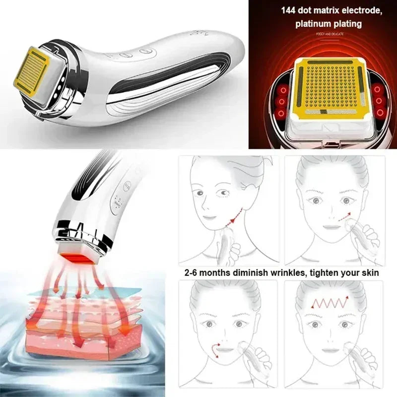 Dot Matrix RF Radio Frequency Face Lifting Device Skin Tightening Beauty Massager  Wrinkle Remover  2