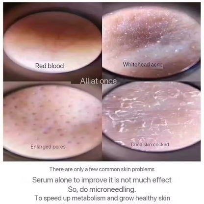 Sponge Microcrystal FreezeDried Powder Collagen Booster Skin Renewal Treatment 2