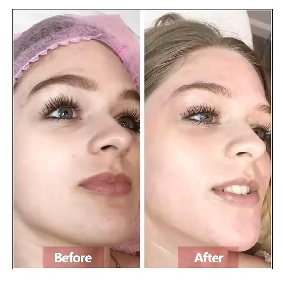 Hyaluronic Acid Facial Serum Skin Rejuvenation Essence 2