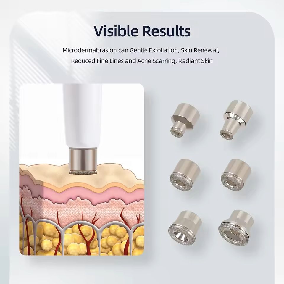 Professional Diamond Microdermabrasion Facial Machine 3