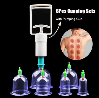 6 Piece Vacuum Cupping Therapy Set with Suction Pump for Body Massage and Cellulite Relief