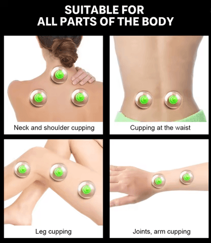 6 Piece Vacuum Cupping Therapy Set With Suction Pump For Body Massage And Cellulite Relief 1