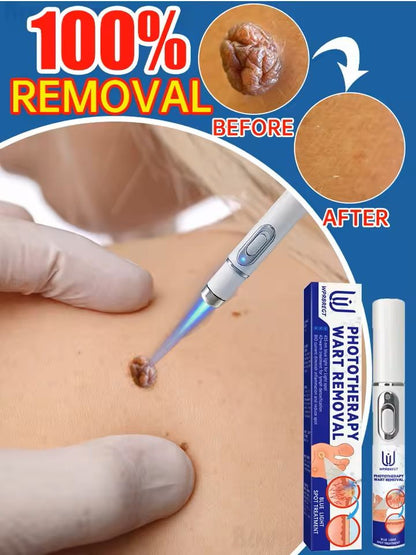 Professional Skin Treatment Device