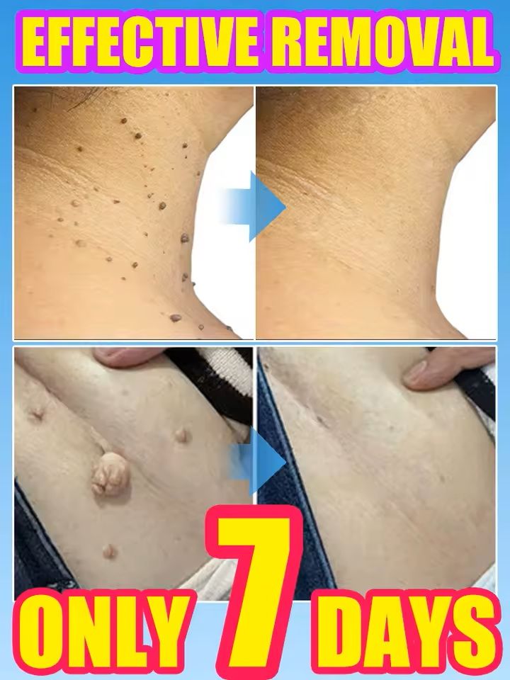 Professional Skin Treatment Device 2