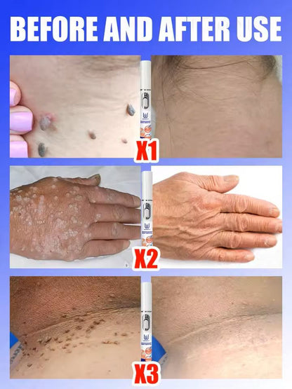 Professional Skin Treatment Device 4