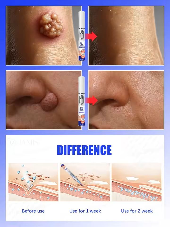 Professional Skin Treatment Device 5