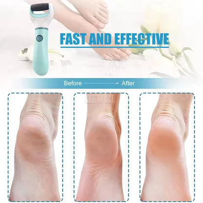 Electric Foot Grinder Wireless Pedicure Tool For Callus And Dead Skin Removal 2