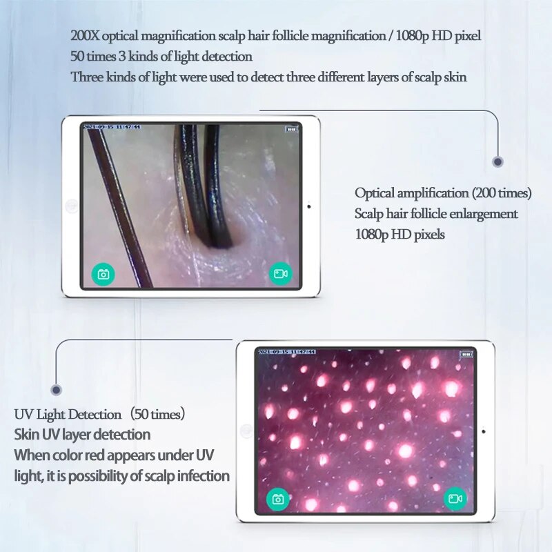 Professional Skin Analyzer Rechargeable UV Testing Analysis Magnifier with Dual Probes & Wi-Fi App Control