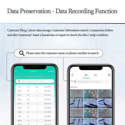 Professional Skin Analyzer Rechargeable UV Testing Analysis Magnifier with Dual Probes & Wi-Fi App Control