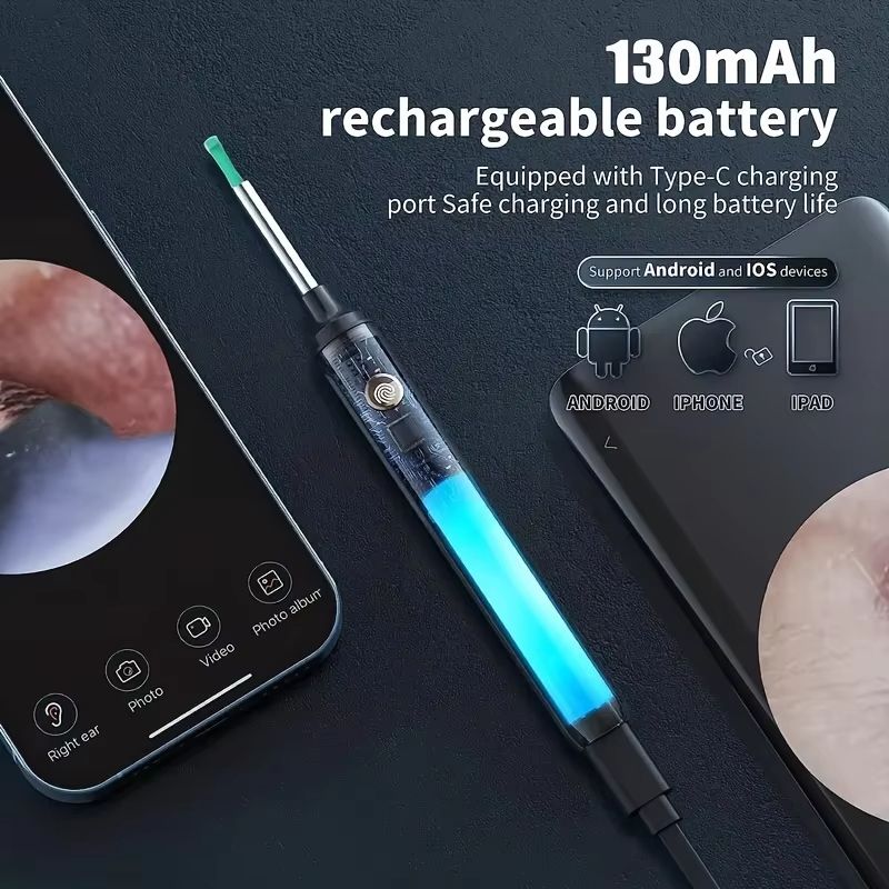 Smart HD Ear Wax Remover with Camera – 1080P Otoscope & LED Ear Cleaner Set
