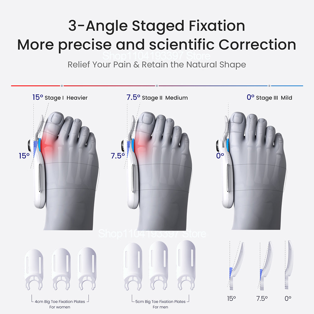 Electric Bunion Corrector Airbag Traction Vibration Orthopedic Foot Hallux Valgus Braces For Toe Co 3