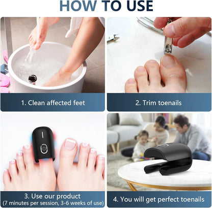 Nail Fungus Laser Device Super Pulsed Invisible Light Smart Remove and Repair Fungal Nail, Portable, Rechargeable