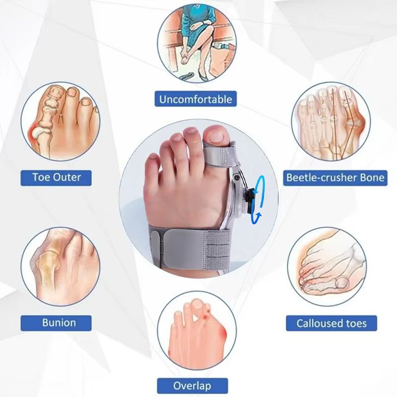 Bunion Corrector Unisex Hallux Valgus Brace  Adjustable Rotatable Toe Separator  Foot Straightener 1