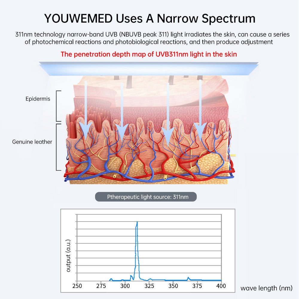 Ultraviolet Phototherapy Instrument use UVB Philips Lamp UV for Vitiligo, Psoriasis, White Spots Skin Disease