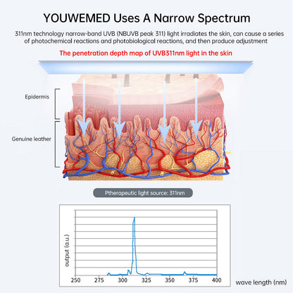 Ultraviolet Phototherapy Instrument use UVB Philips Lamp UV for Vitiligo, Psoriasis, White Spots Skin Disease