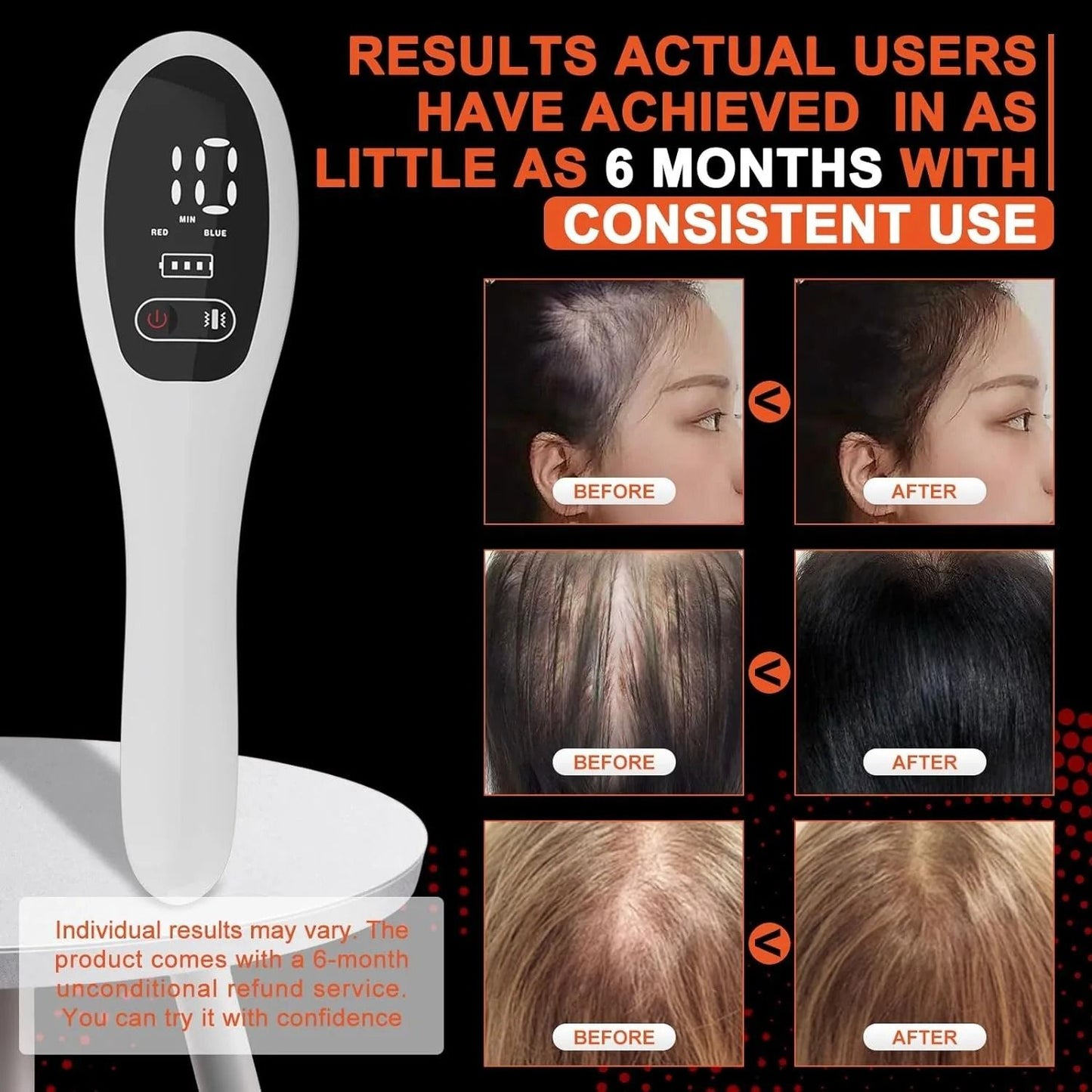 Electric Laser Therapy Comb For Hair Growth And Scalp Massage 4