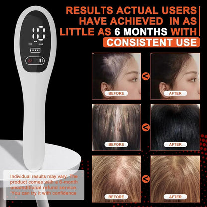 Electric Laser Therapy Comb For Hair Growth And Scalp Massage 4