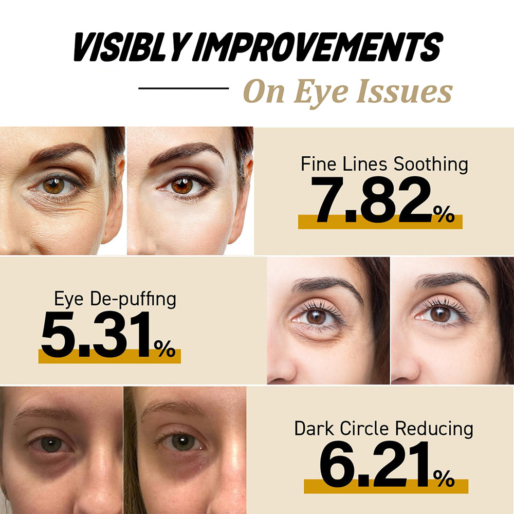 Brightening Snail Peptide Eye Cream Stick, Reduce Dark Circles and Puffiness with Intensive Moisturizing and Firming