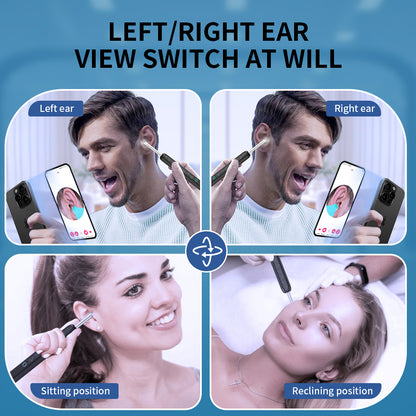 Dropshipping Ear Cleaner with Camera, Wireless Otoscope Earpick with USB C Charging, Mini Endoscope Wax Removal Tool