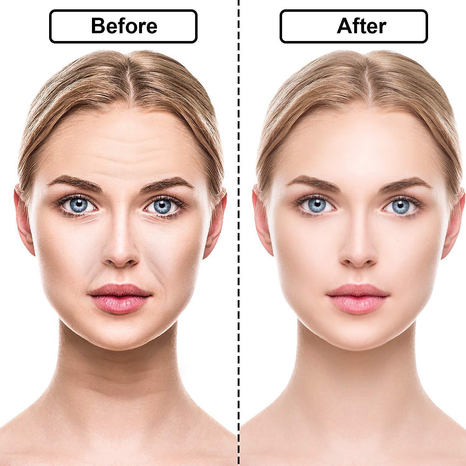 Anti Wrinkle Sticker Silicone Reusable Face Forehead Neck Skin Care Lifting Patch Anti Aging Faci Facial Firming Pad