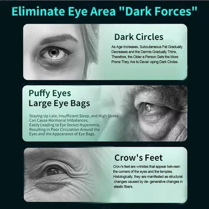 EMS Eye Massager For Dark Circles And Fatigue Relief 4