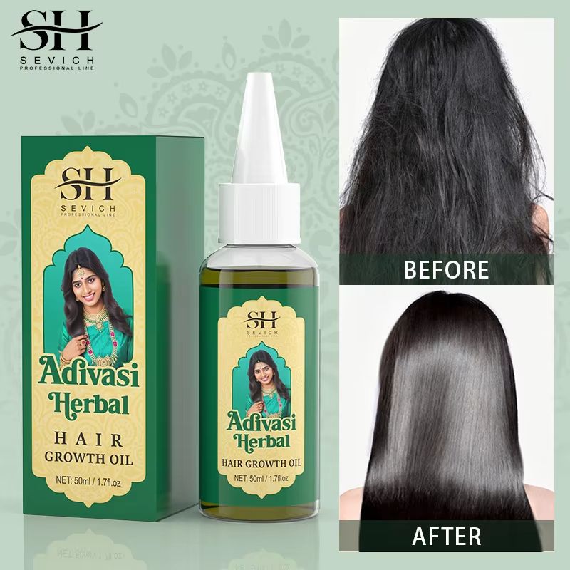 Ayurvedic Hair Growth Oil India Adivasi Organic Serum For Fast Regrowth And Anti Hair Loss 1