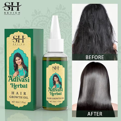 Ayurvedic Hair Growth Oil India Adivasi Organic Serum For Fast Regrowth And Anti Hair Loss 1