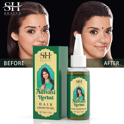 Ayurvedic Hair Growth Oil India Adivasi Organic Serum For Fast Regrowth And Anti Hair Loss 4