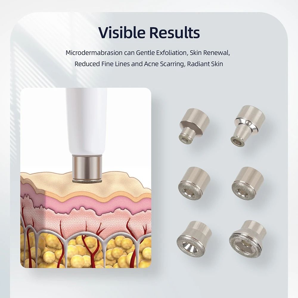Diamond Microdermabrasion Machine For Deep Facial Exfoliation And Skin Cleansing At Home 2