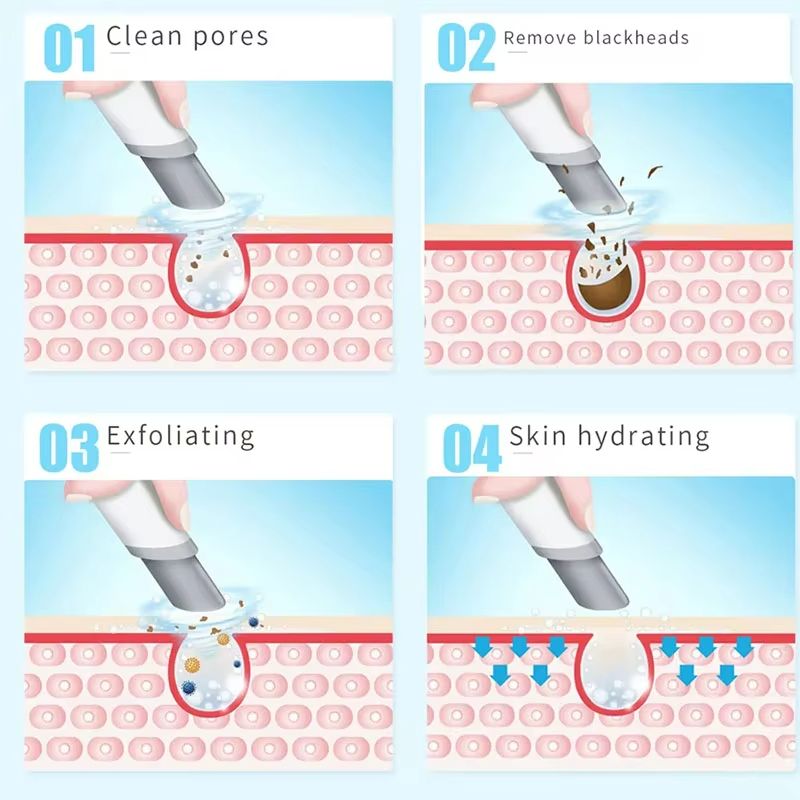 PureAqua 6in1 Hydra Dermabrasion Oxygen Facial Device 5