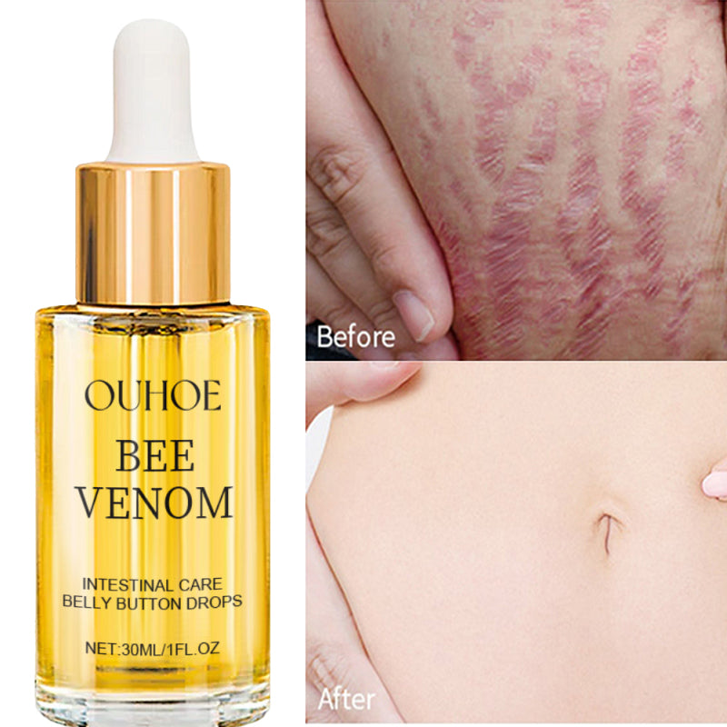 Postpartum Repair Essential Oil Fade Stretch Marks Fat Lines Big Belly Recovery Body Massage Oil Sk 2