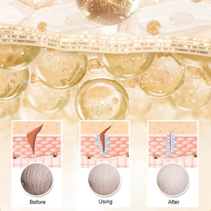 Postpartum Repair Essential Oil Fade Stretch Marks Fat Lines Big Belly Recovery Body Massage Oil Sk 3