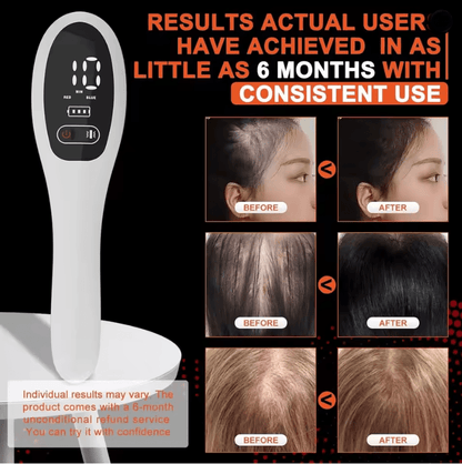 RevitaLaser 650nm Red Light Laser Hair Growth Comb 2