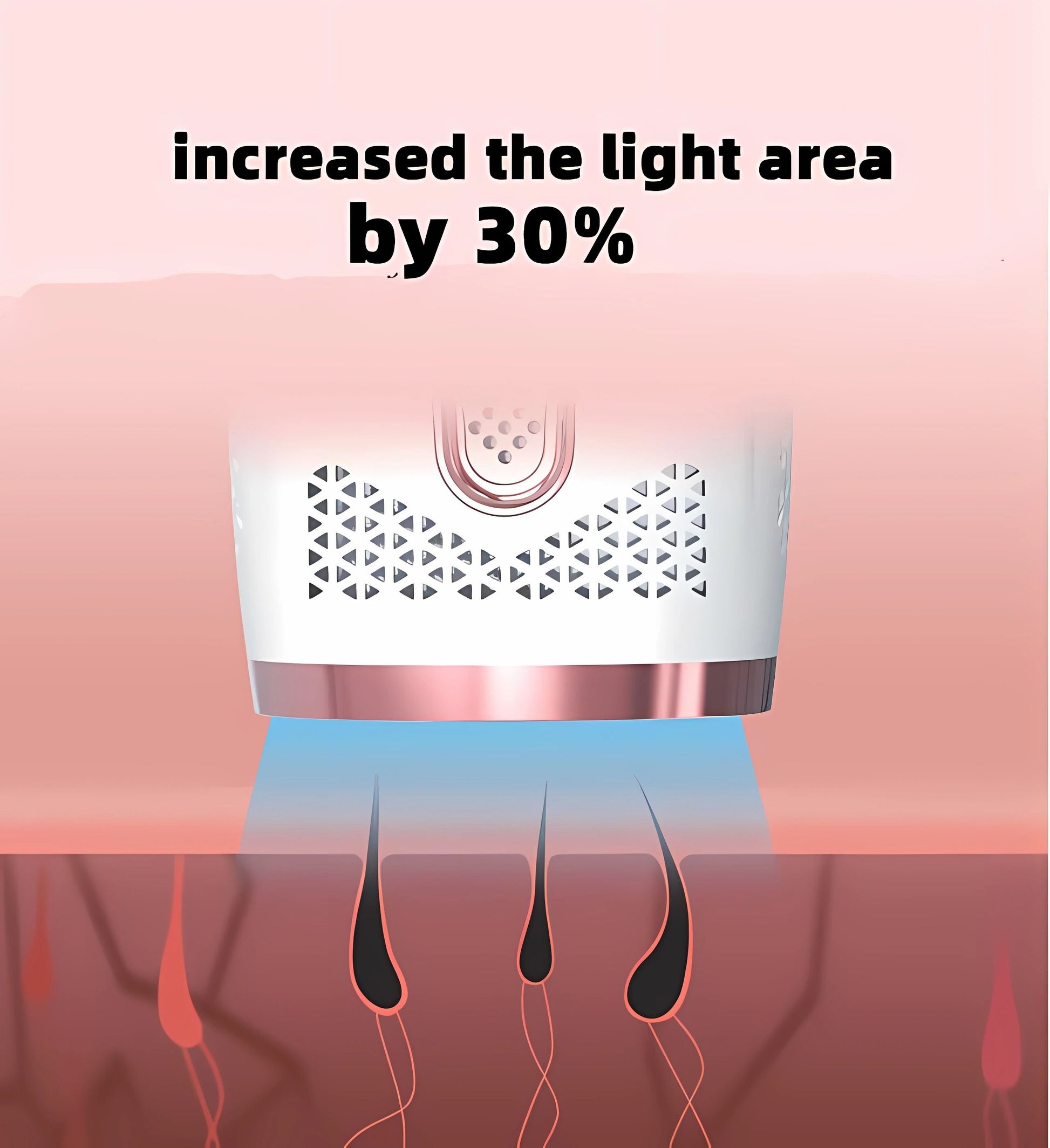 IPL Hair Removal Device With 999999 Flashes For Permanent Hair Reduction 2