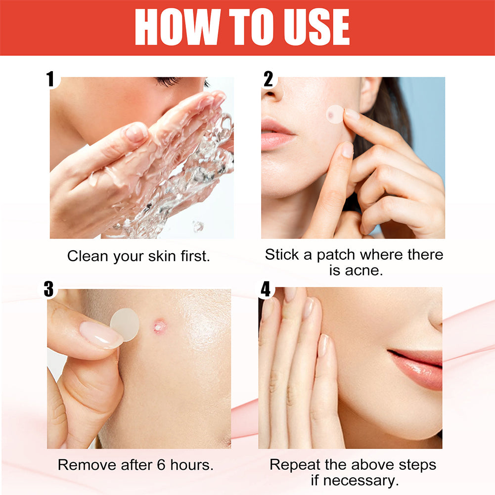 New Highend Pimple Patch Acne Patches In Heart Star Shapes Acne Dots Patches Moisturizes Covering Z 3
