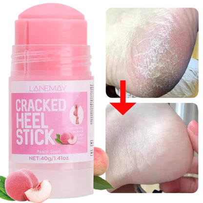 Moisturizing Cracked Cream for Heels Elbows Knees, Ultra Hydrating Foot Care, Softens Calluses, Dead Skin Removal