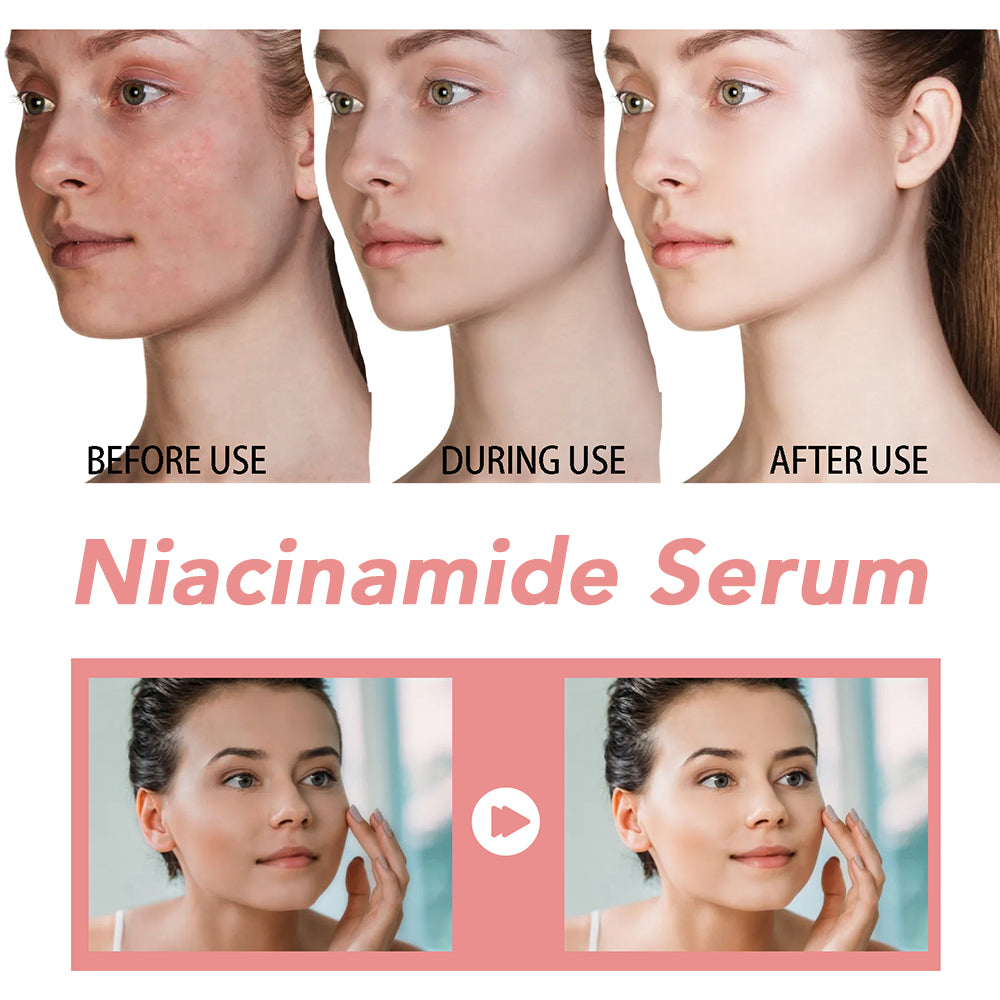 Niacinamide Facial Serum Hyaluronic Acid Vitamin B12 Essence Pore Minimizer Brightening Glowing Ski 5